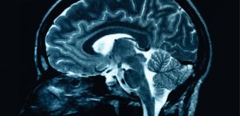 fate freedom and neuroscience