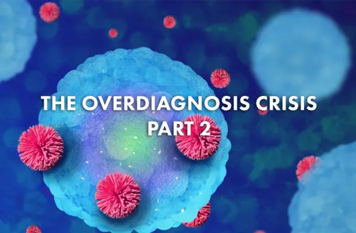 The overdiagnosis crisis part 2