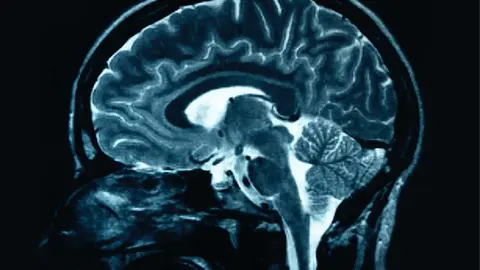 Fate, freedom, and neuroscience